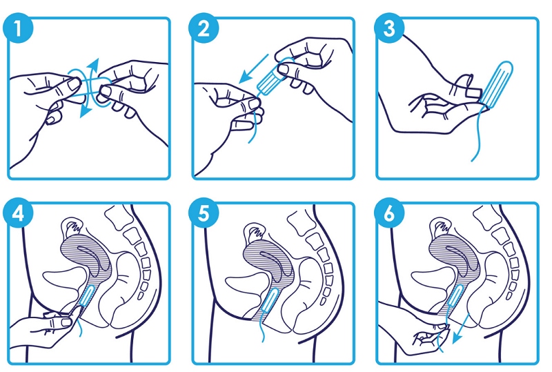Các bước đặt tampon đúng cách